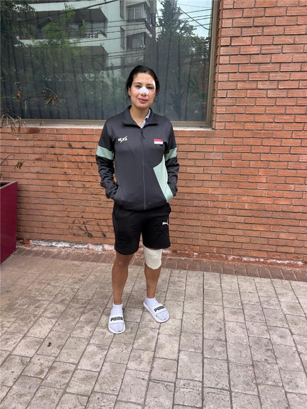 صورة | الاصابة تحرم ابتسام زايد من استكمال بطولة العالم للدراجات