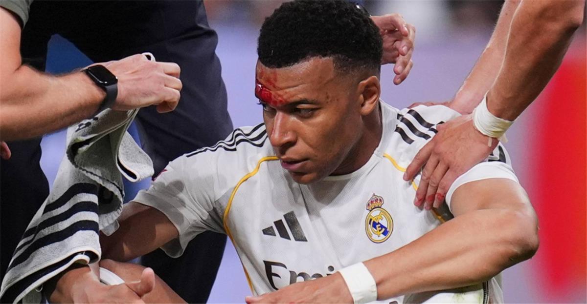 إجراء احترازي لحماية مبابي في مباراة ريال مدريد وبايرن ميونخ